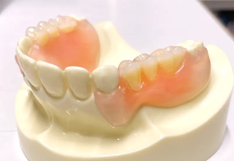 ノンクラスプデンチャー